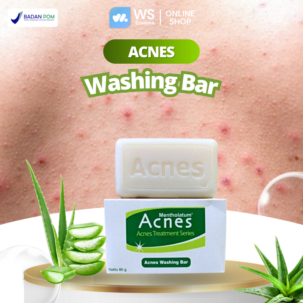 Sabun Jerawat Di Punggung dan Dada Acnes Washing Bar 80gr untuk menghilangkanJerawat diDada Punggung