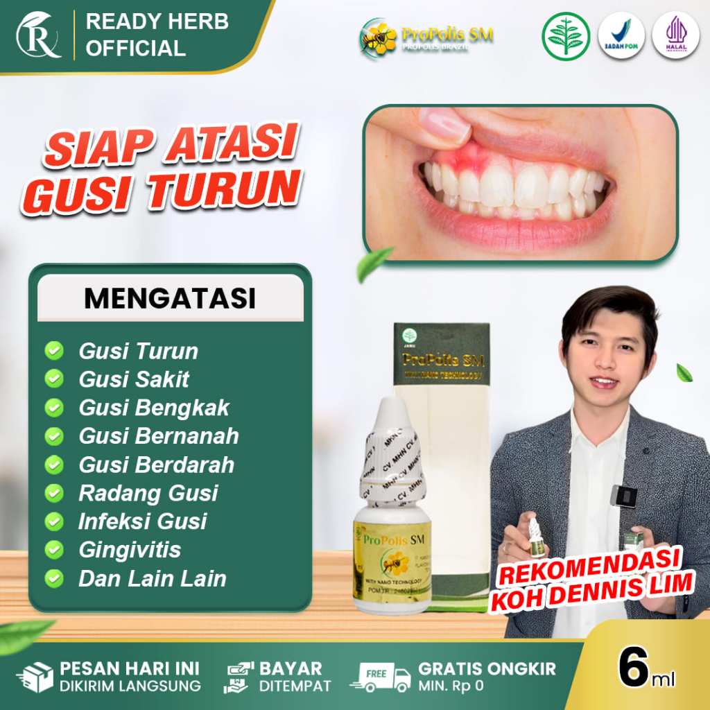 PROPOLIS SM Obat Gusi Turun Sakit Bengkak Bernanah Berdarah Radang Gusi Gingivitis Infeksi Gusi