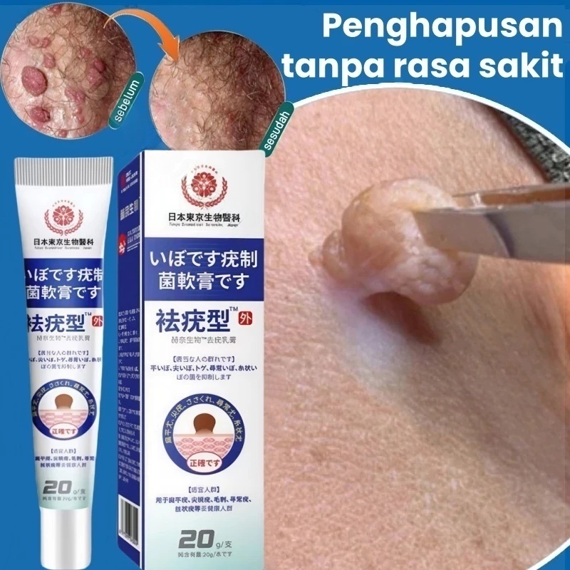 0bat kutil ampuh Penghilang kutil dan tahi lalat Salep kutil paling ampuh Menghilangkan Kutil Di Leh
