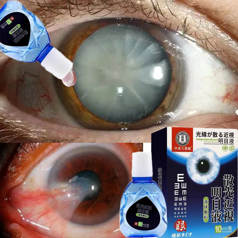 Obat Tetes Mata Obat Mata Katarak Eye Drop Obat Mata Buram Obat Mata Berlemak Tetes Mata Herbal Mata