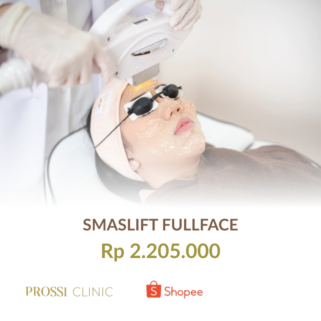Prossi Clinic - SmasLift Fullface ( penirus wajah, penghilang lemak wajah)