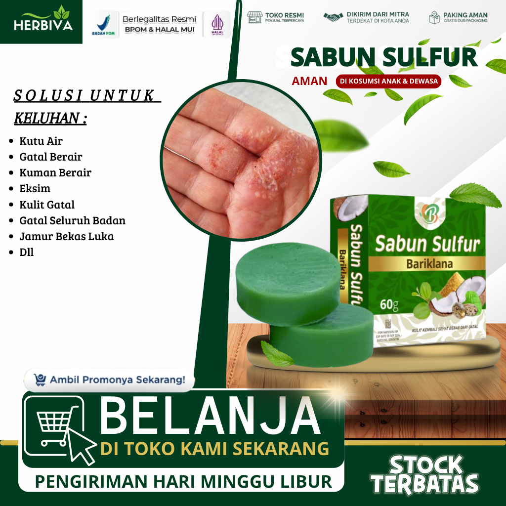 Sabun Sulfur - Obat Kutu Air, Penghilang Kuman Air, Gatal Berair, Kutu Air Pada Kaki, Jamur Kaki, Ku