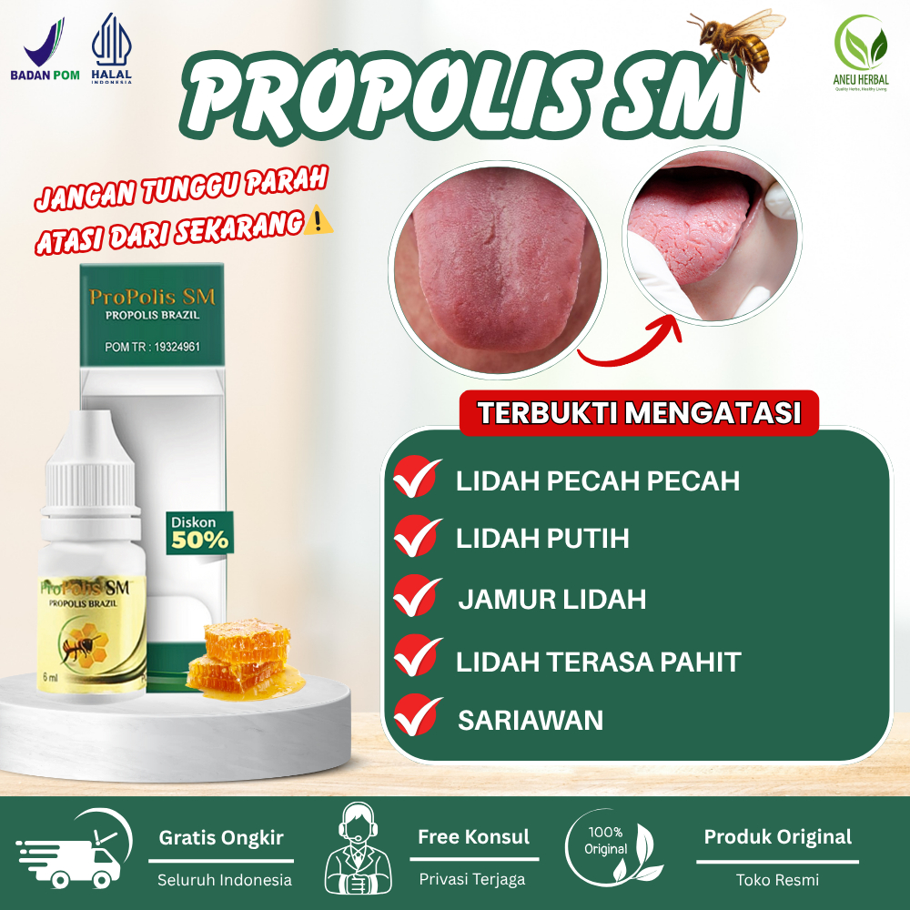 Obat Lidah Pecah Pecah, Lidah Putih, Jamur Lidah, Lidah Pahit - Propolis SM