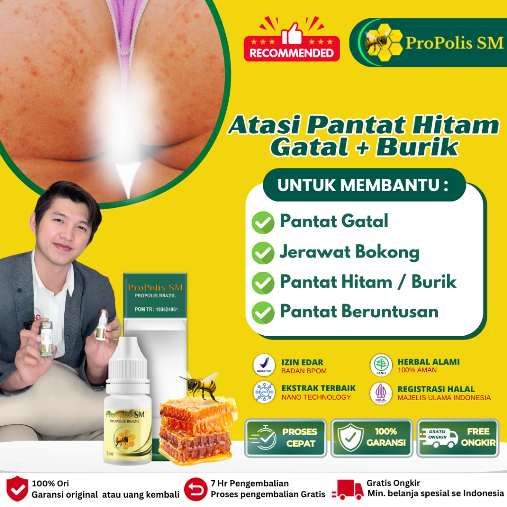 Obat Oles Gatal Pantat, Obat Gatal Di Pantat, Obat Gatal Pantat Bokong, Obat Penghilang Gatal Berunt