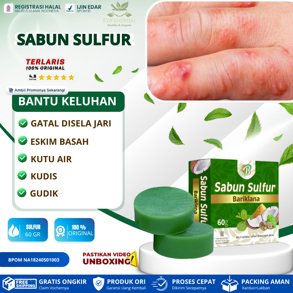 SABUN SULFUR untuk gatal berair di sela jari tangan atau kaki akibat kutu air, dermatitis dishidroti