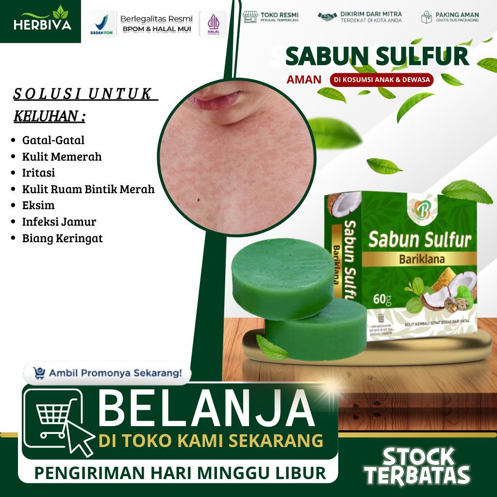 Sabun Sulfur Sabun Gatal Scabies Manusia Gatal Bernanah Gatal Budug Anak Dan Dewasa Penghilang Bekas