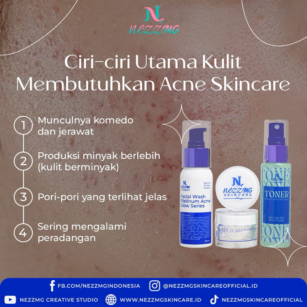 skincare nezzmg acne platinum