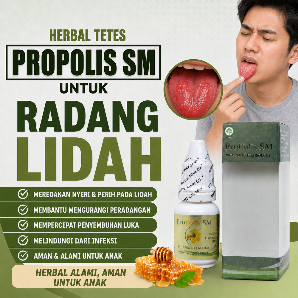Obat Radang Lidah,Lidah Terasa Pahit,Luka Di Lidah,Sariawan Di Lidah,Kanker Lidah, ProPolis SM