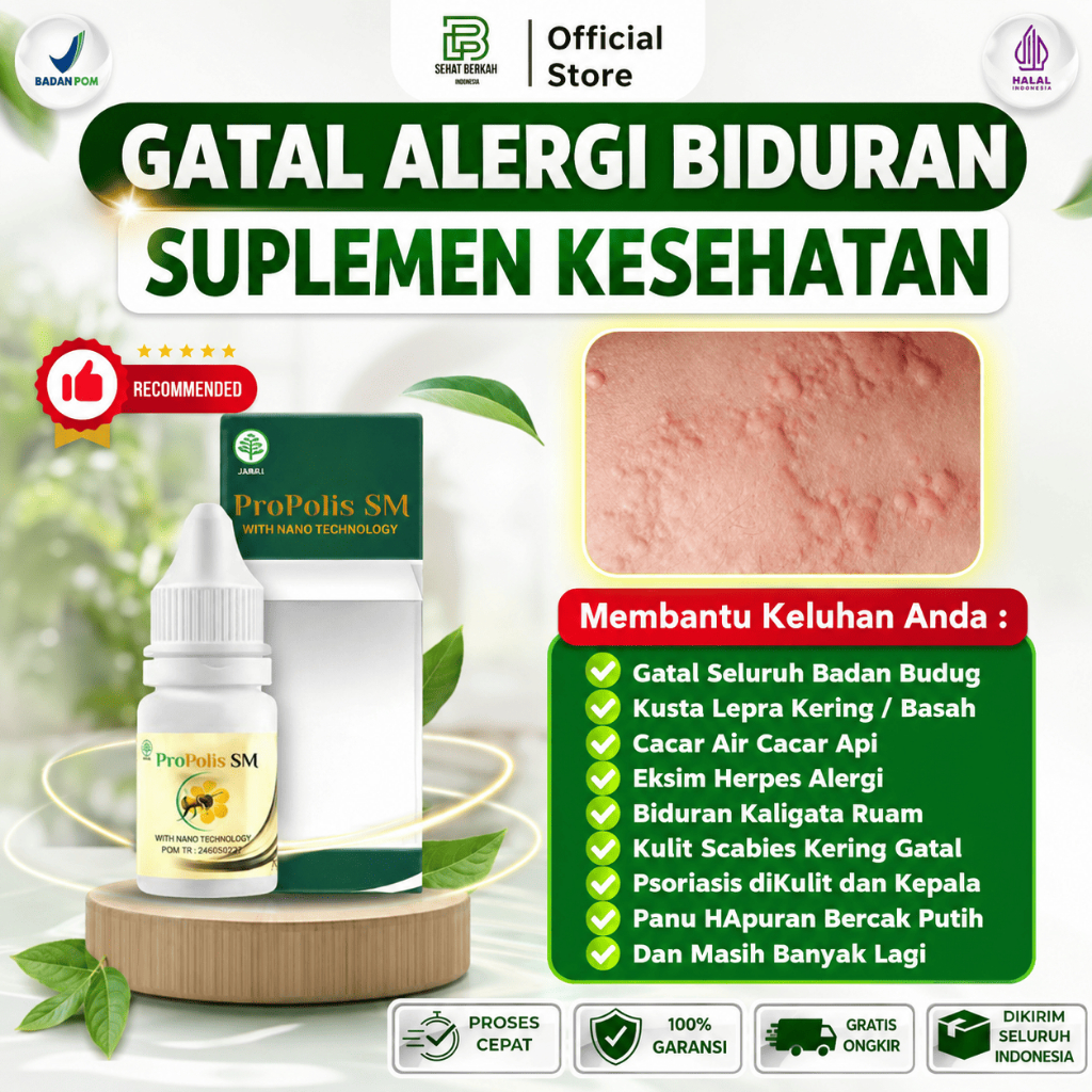 Obat Biduran Kaligata Gatal Alergi Bentol Kulit Merah Kaligata dengan PROPOLIS SM BPOM