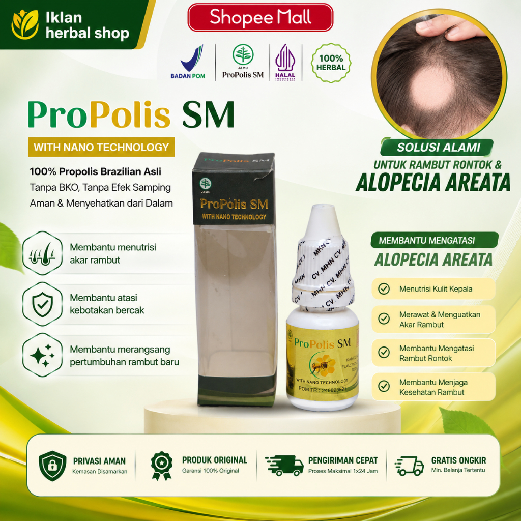Propolis SM Obat Alopecia Areata, Penumbuh Rambut Pitak Botak, Psoriasis Kulit Kepala