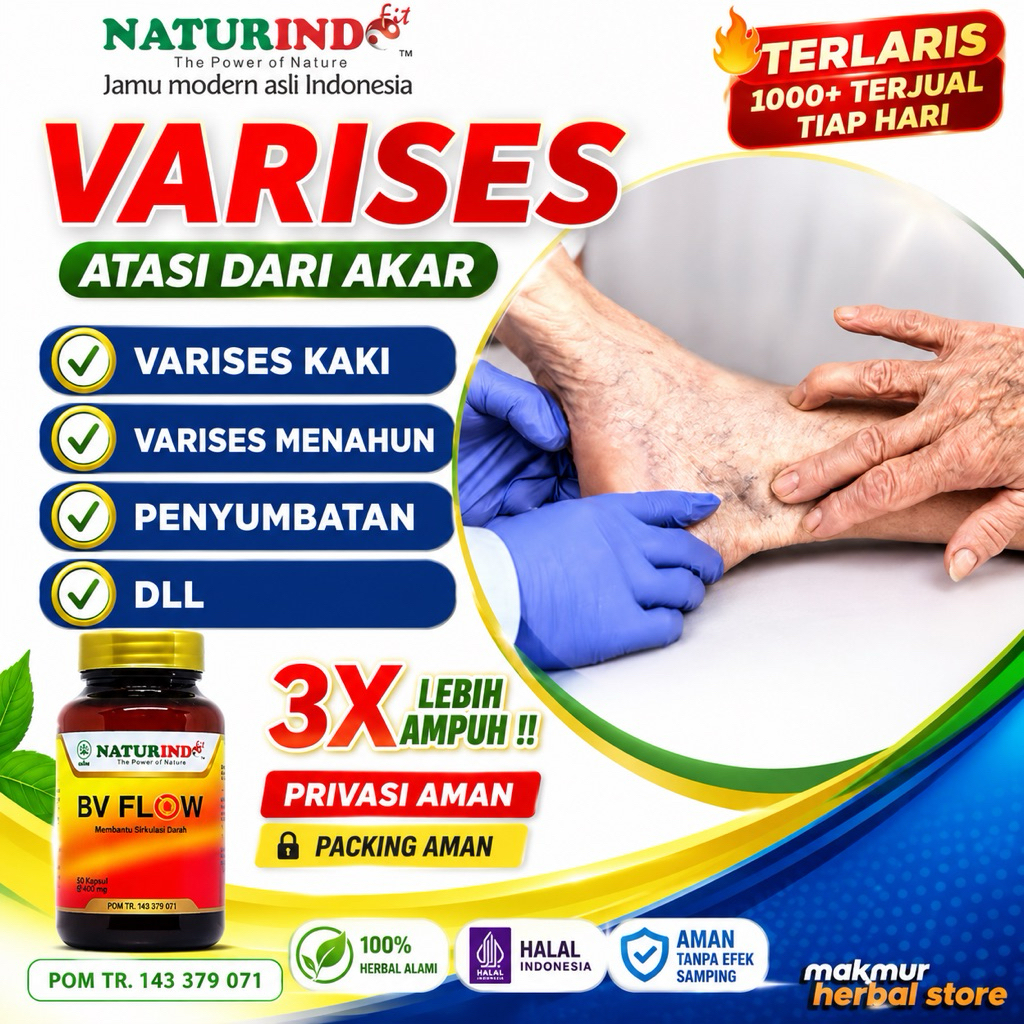 OBAT HERBAL VARISES, VARISES KAKI, VARISES PERMANEN, TANGANI VARISES ALAMI AMPUH