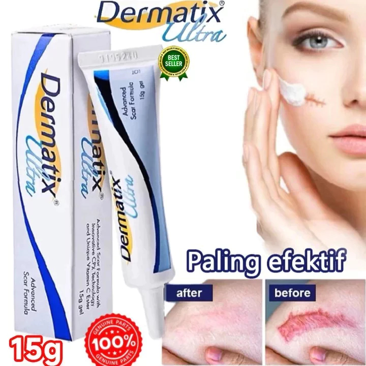 ASLI ORIGINAL100% Dermatix Ultra 15Gr Cream Penghilang Bekas Luka,Bekas Jerawat,Bekas Koreng