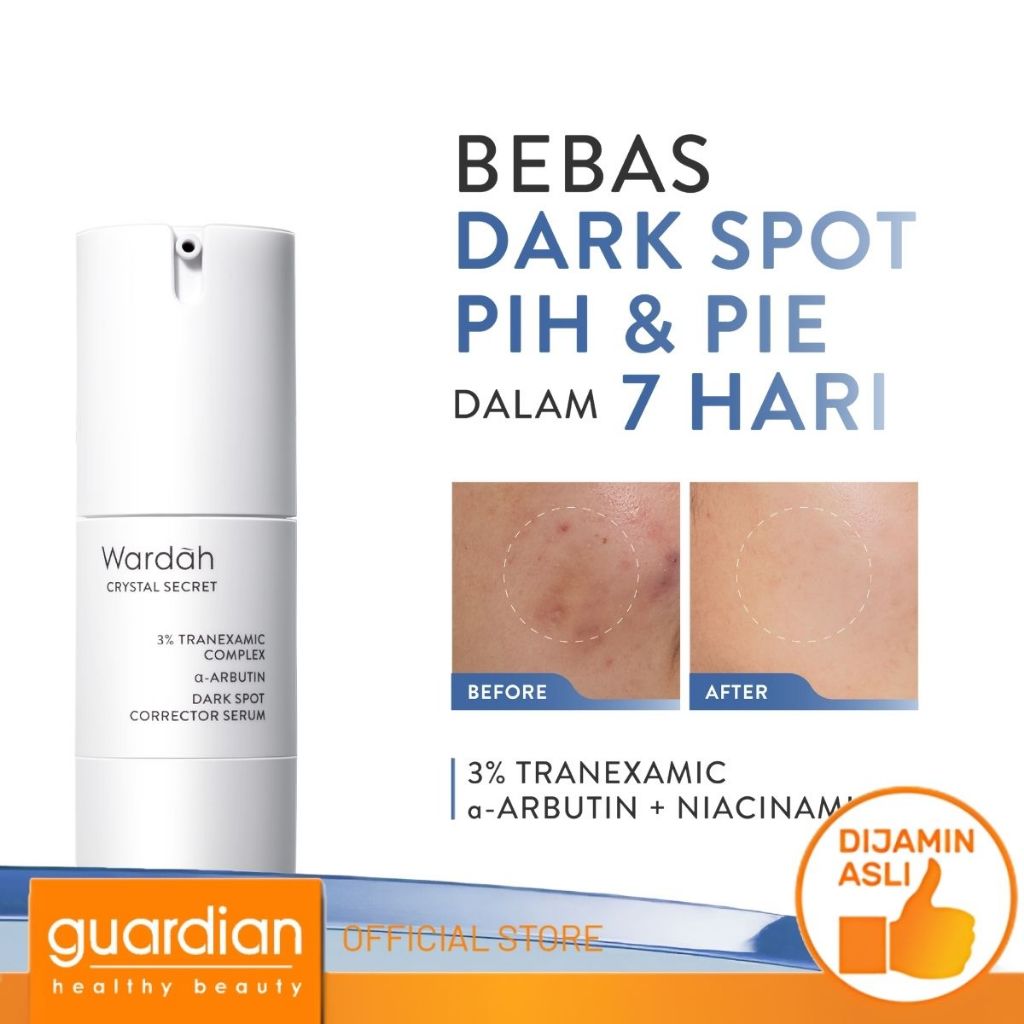 Wardah Crystal Secret Serum Niacinamide Tranexamic Acid TXA + Alpha Arbutin Dark Spot Brightening Se