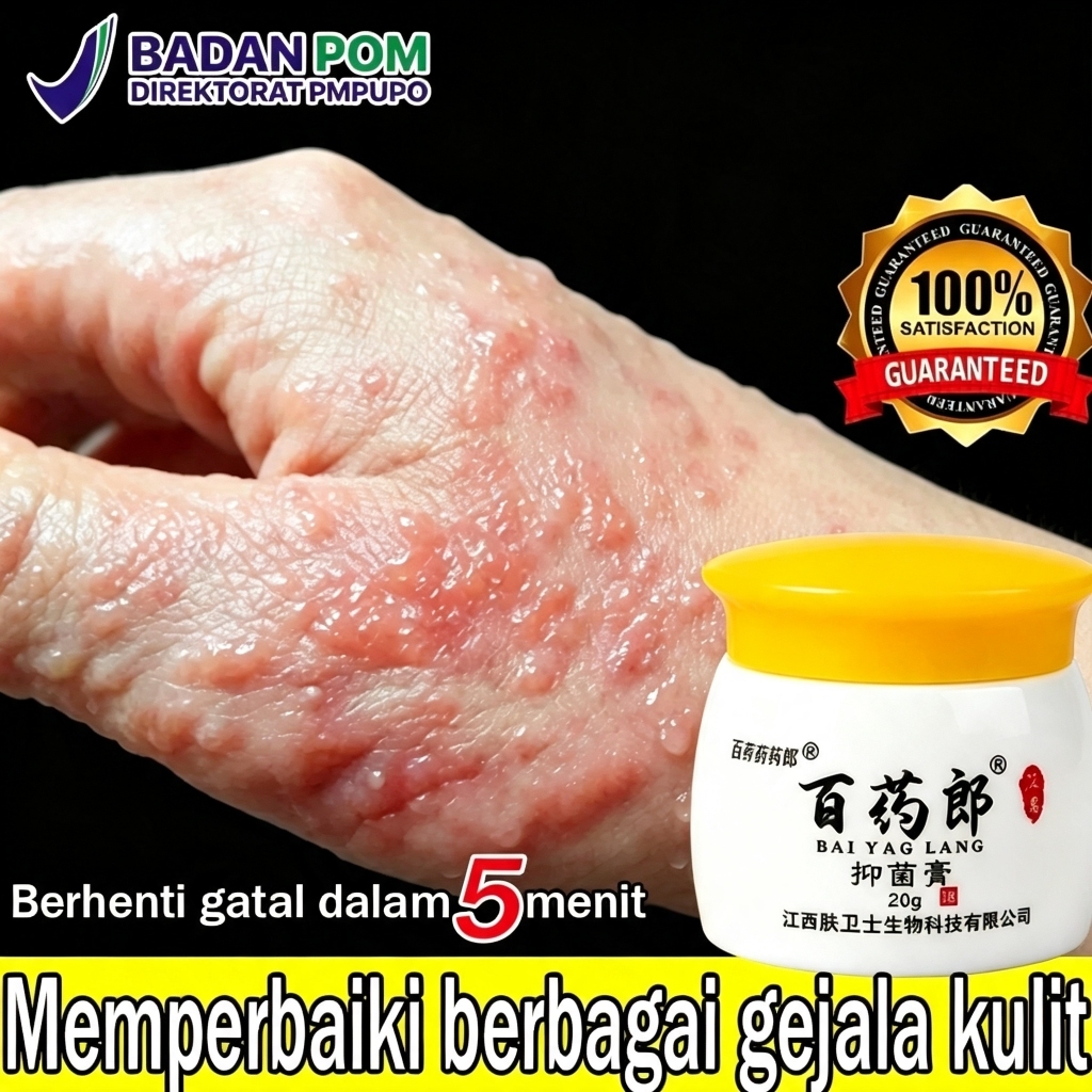 Salep Eksim Kering dan Gatal Salep Gatal China Paling Ampuh Obat Gatal Selangkangan Salep Bayi Untuk