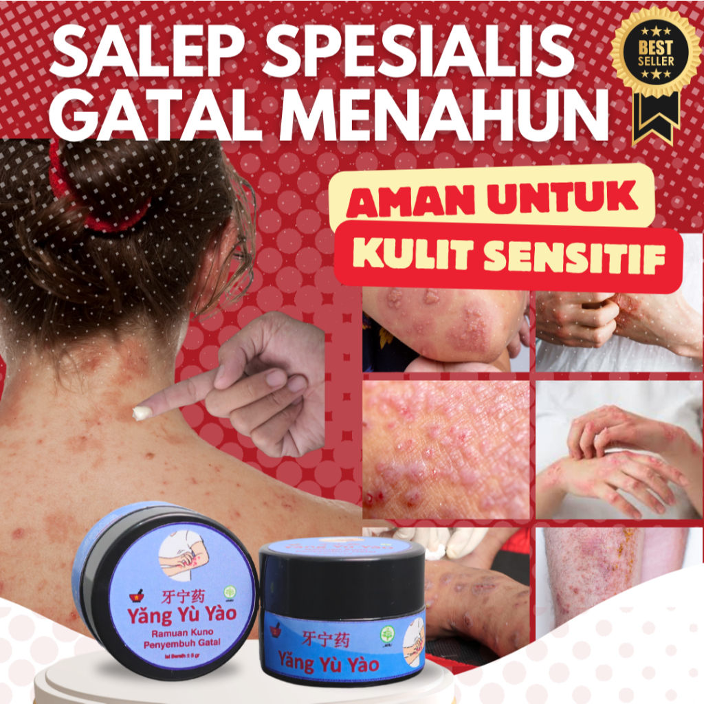 Salep Gatal Menahun Yu Yao Obat Gatal Cina