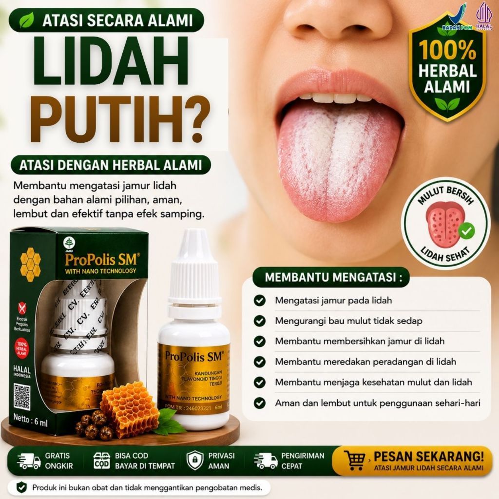 Obat Jamur Lidah Putih, Obat Radang Lidah Putih, Obat Mulut Pecah Pecah, Obat Infeksi Jamur, Obat Li