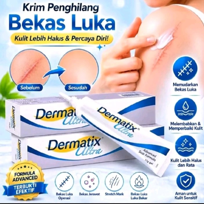 Cream Penghilang Bekas Luka 15gr Merawat dan memudarkan Bekas Luka - Bisa Menghilangkan Bekas Luka Y