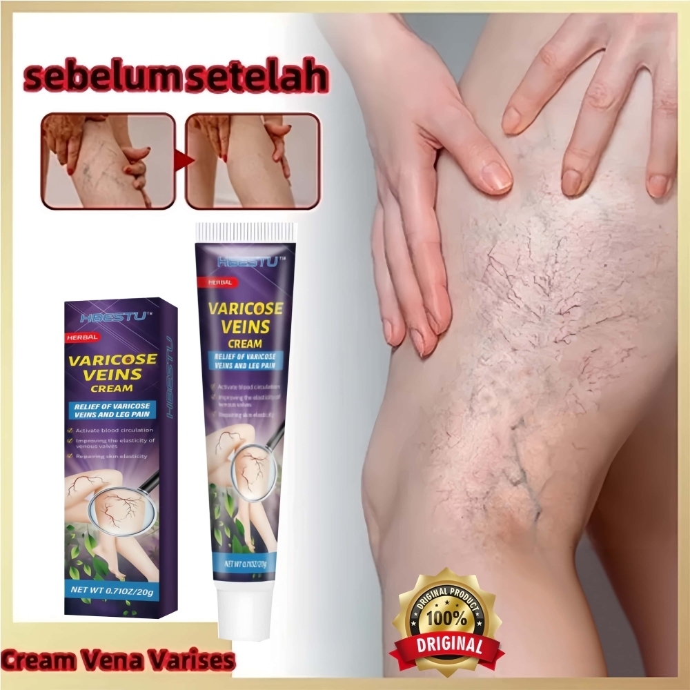 Varicose Veins Cream 20g obat varises di kaki dan betis paling ampuh salep varises Ampuh Tanpa Opera
