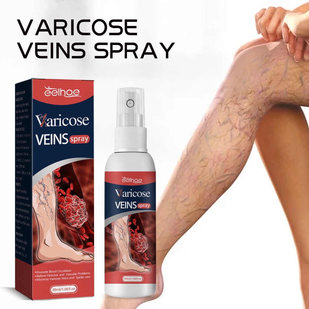EELHOE Varicose Veins Spray 30ml Semprotan Penghilang Varises Pengobatan Vaskulitis Pengobatan Varis