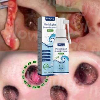 Nasal Spray Semprotan Hidung Sinusitis Semprotan Hidung Tersumbat Dapat Digunakan Untuk Hidung Kerin