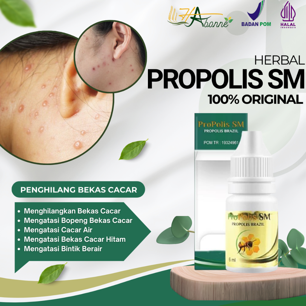 Obat Penghilang Bekas Cacar, Obat Bekas Cacar, Penghilang Bekas Cacar Air, Bekas Cacar Hitam, Bintik