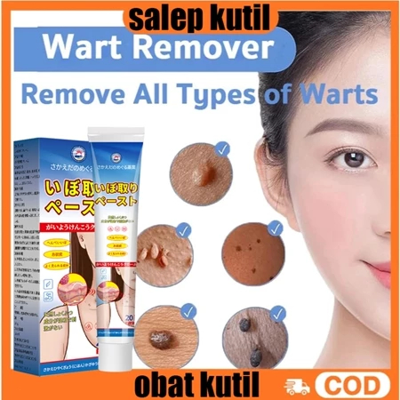 Wart remover obat kutil ori Obat Kutil paling ampuh Obat Kutil Kelamin Wart Remover Skin Tag Remover