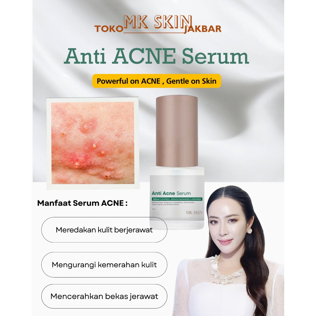 Serum Jerawat MK Skin – Mengurangi Minyak, Kemerahan & Bekas Jerawat