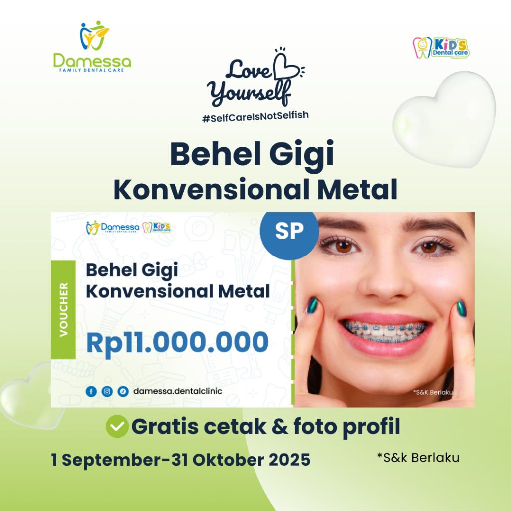 Voucher Behel Gigi Damessa - Pasang Behel Gigi Konvensional Metal Dokter Gigi Spesialis (SP)
