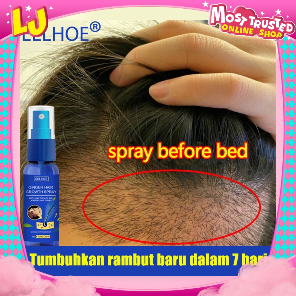 EELHOE Hair Growth Spray Semprotan Penumbuh Rambut Hair Growth Serum Hair Growth Spray Repair Damage