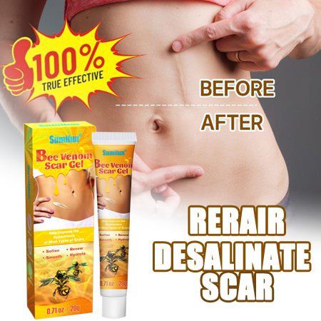 Penghilang bekas luka Salep penghilang bekas luka Obat bekas luka secara efektif menghilangkan bekas