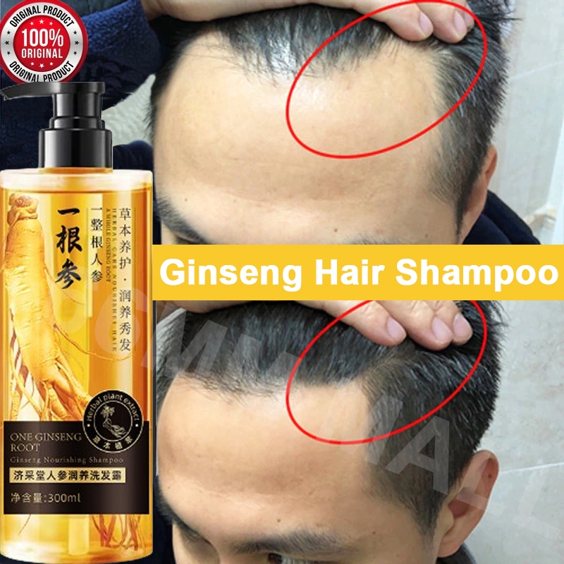 【ORIGINAL】ginseng shampoo shampo anti rontok sampo rambut rontok shampo penumbuh rambut shampoo natu