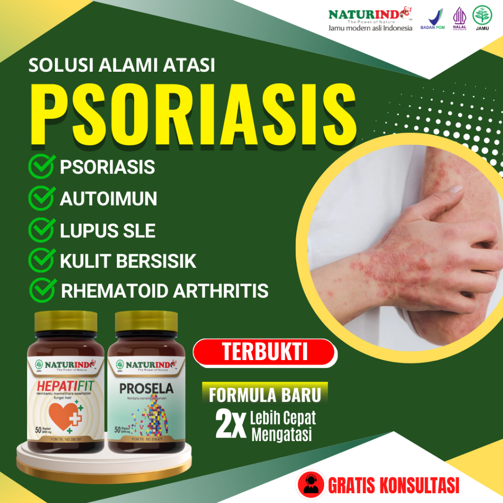 Obat Autoimun Psoriasis Nyeri Sendi Lupus Obat Gatal Alergi Biduran Herbal Ampuh