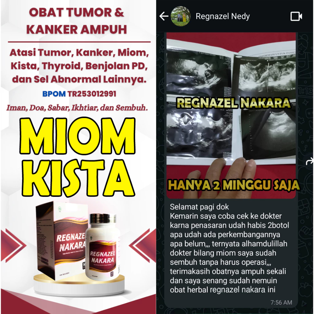 Obat Kista Ovarium, Kista Bartholin, Kista Epidermoid, Kista Endometriosis, Penghilang Benjolan
