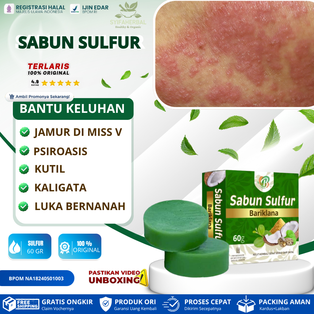 SABUN SULFUR - Sabun Gatal Paling Ampuh Anti Jamur, Gatal-gatal Seluruh Badan, Sabun Gatal Kulit, Sa