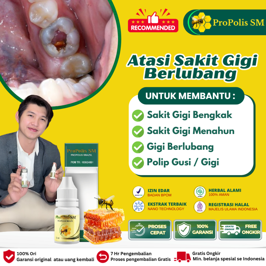 Obat Gigi Berlubang Sampe Akar - Obat Perontok Gigi Berlubang Sampe Akar Agar Copot - Obat Sakit Gig