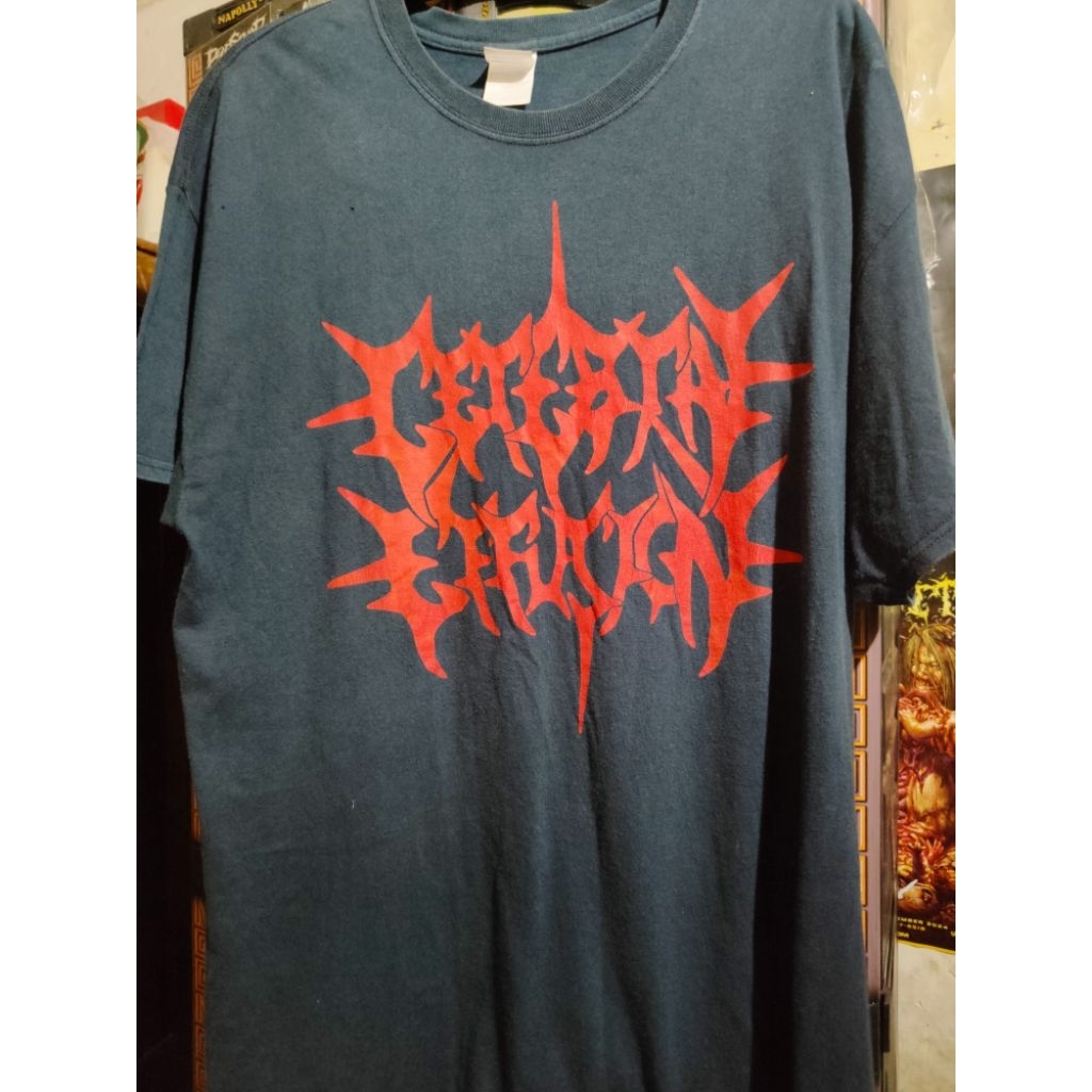 TS cerebral effusion logo NSE