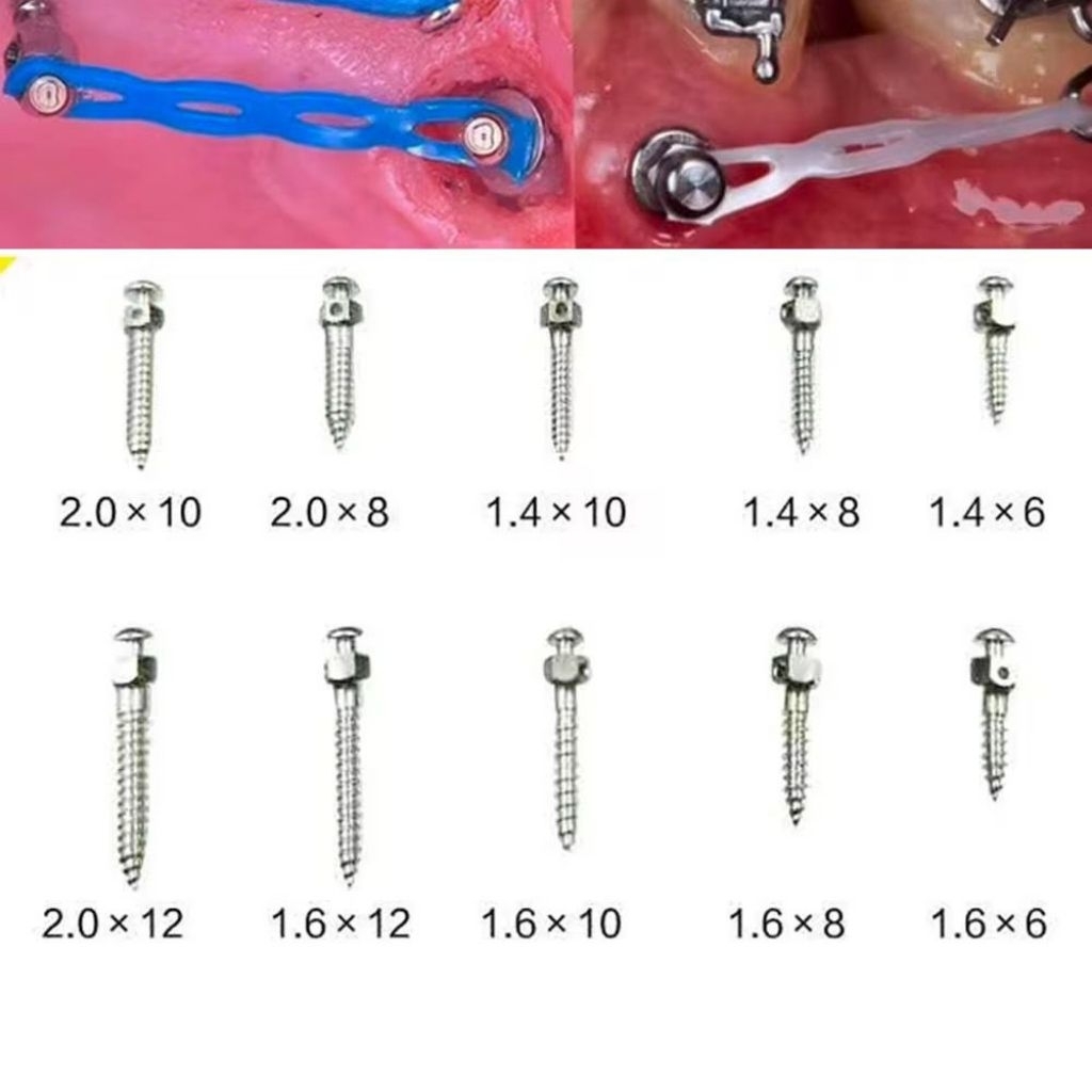 mini screw implan implant orthodontic screw ortho behel braces screwdriver