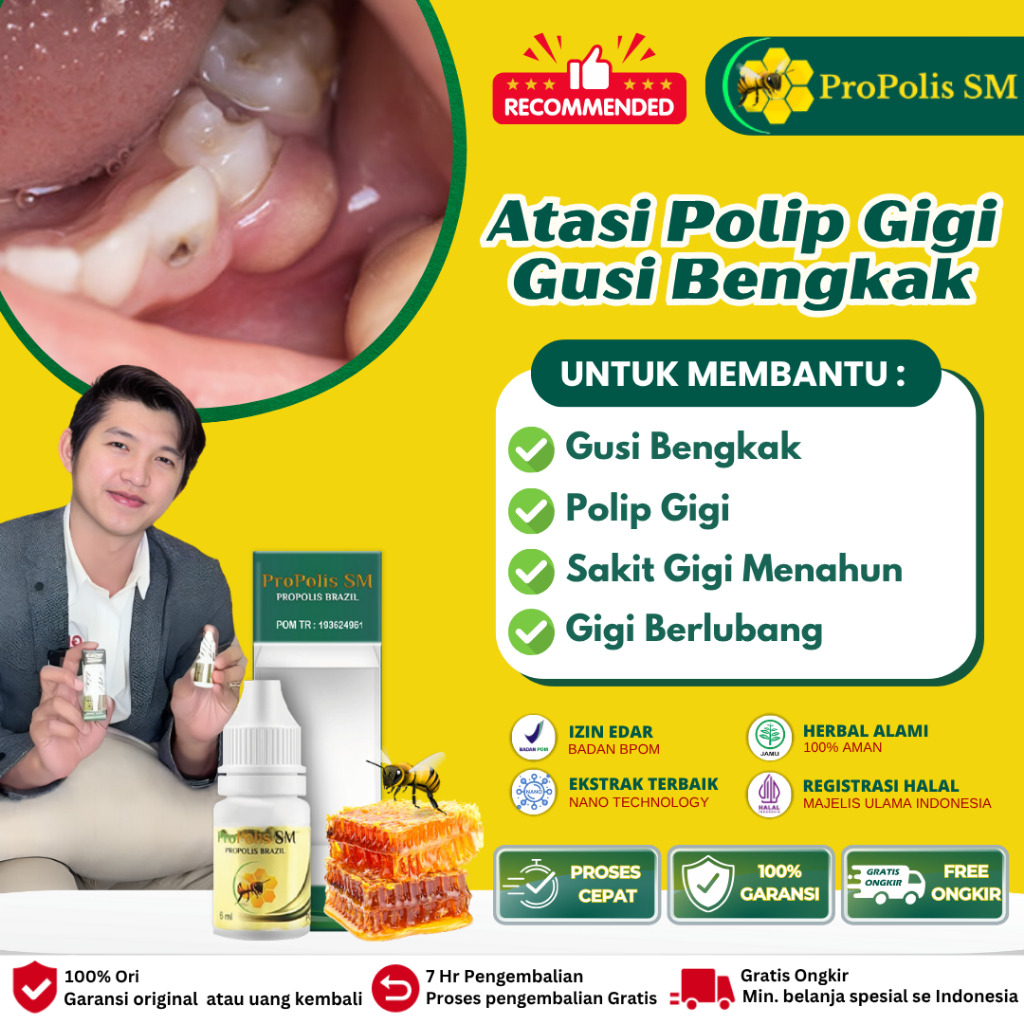 Obat Sakit Gigi Radang Gusi, Gusi bengkak, Obat Herbal Sakit Gusi Gigi Berlubang Gusi Bengkak Gigi A