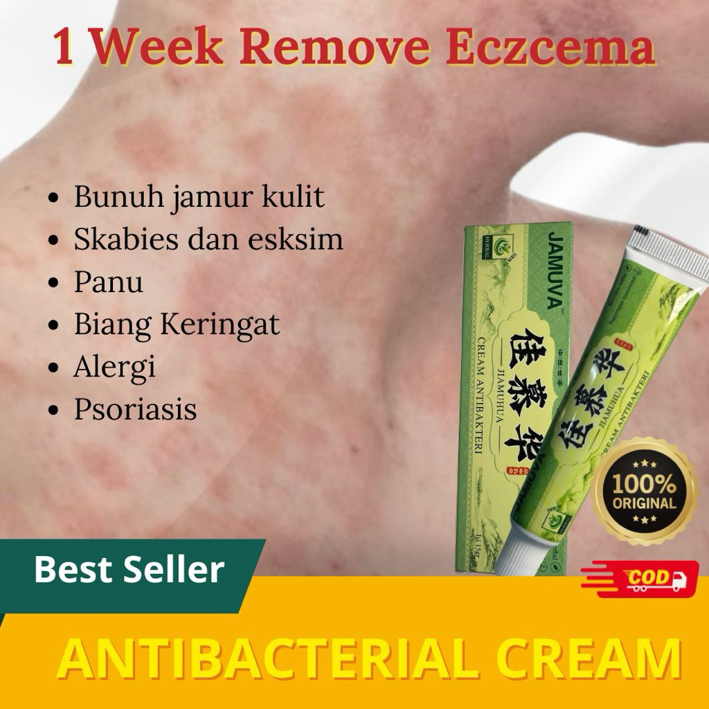 Salep Gatal Paling Ampuh Salep Gatal Selangkangan Dan Hitam Jamur Herpes Alergi Kulit Cream Herbal