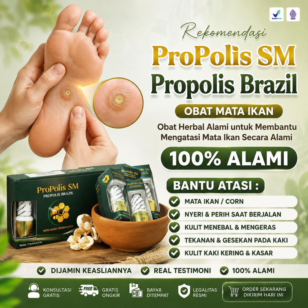 Obat Mata Ikan Telapak Kaki / Mata Ikan Telapak Tangan, Clavus, Salep Mata Ikan Jari Tangan Dan Kaki