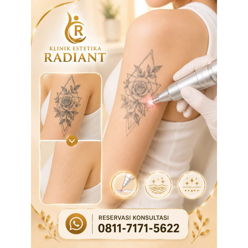 Laser Hapus Tato/Lesi