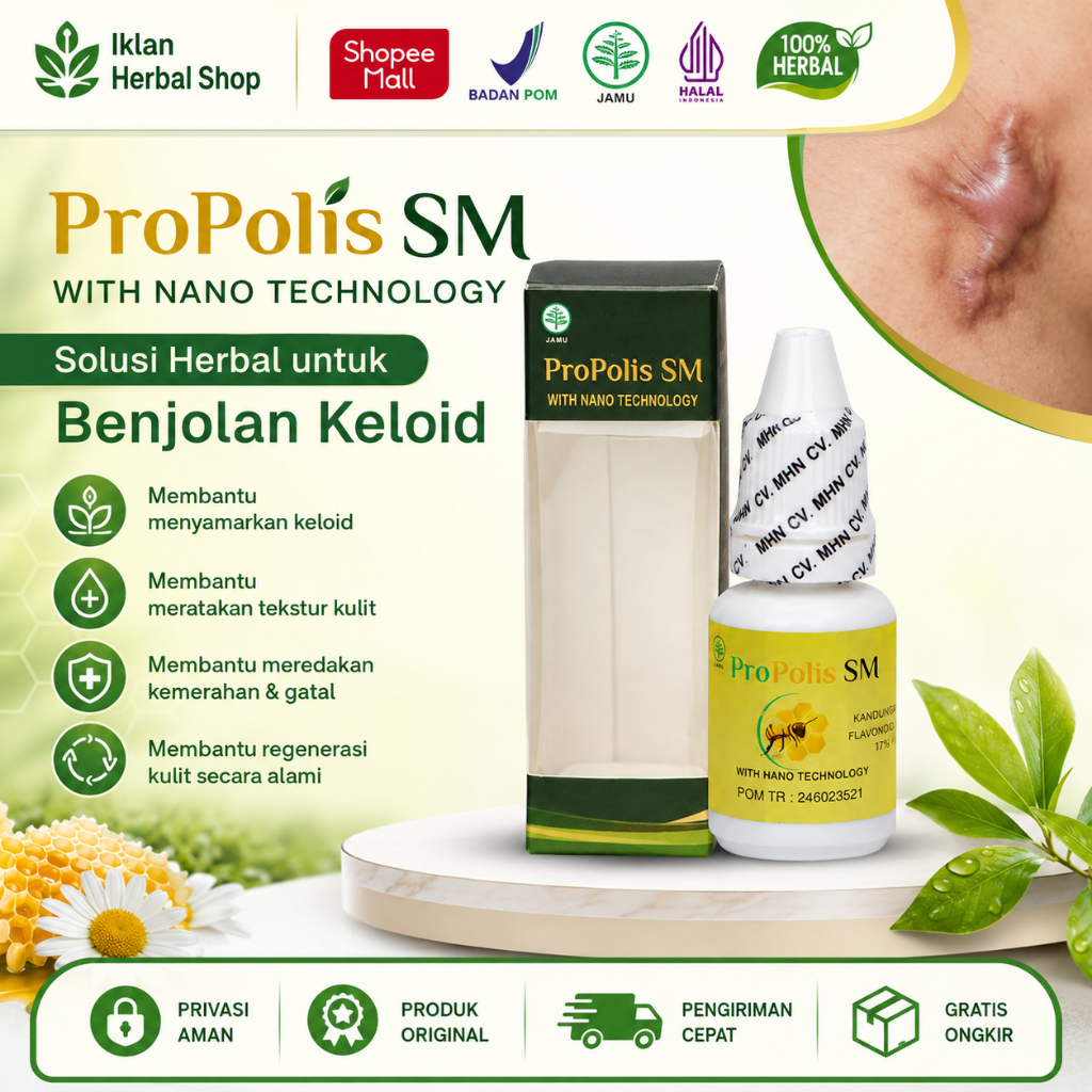 Obat Benjolan Keloid Ampuh yang Banyak Digunakan, dengan Efek yang Dapat Beragam Propolis SM