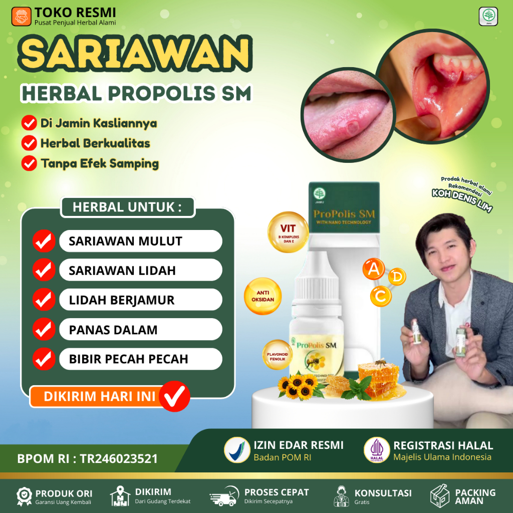 Obat Sariawan Di Mulut Bibir Dan Lidah Bau Mulut Bibir Kering Dan Pecah Pecah Panas Dalam Lidah Berj