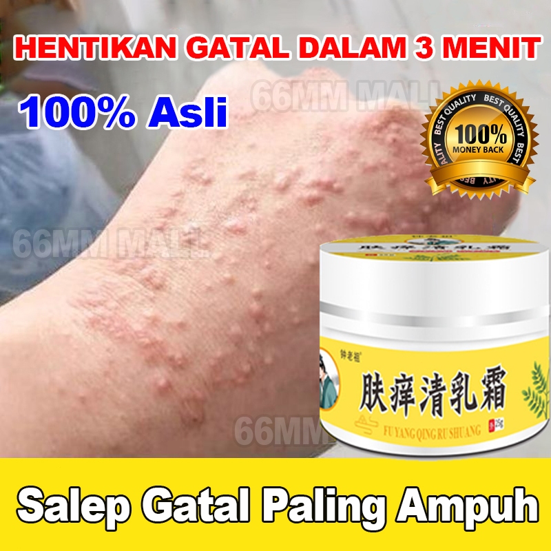 Salep Eksim Kering dan Gatal Salep Gatal China Paling Ampuh Bayi Salep Selangkangan Eksim Dan Jamur 