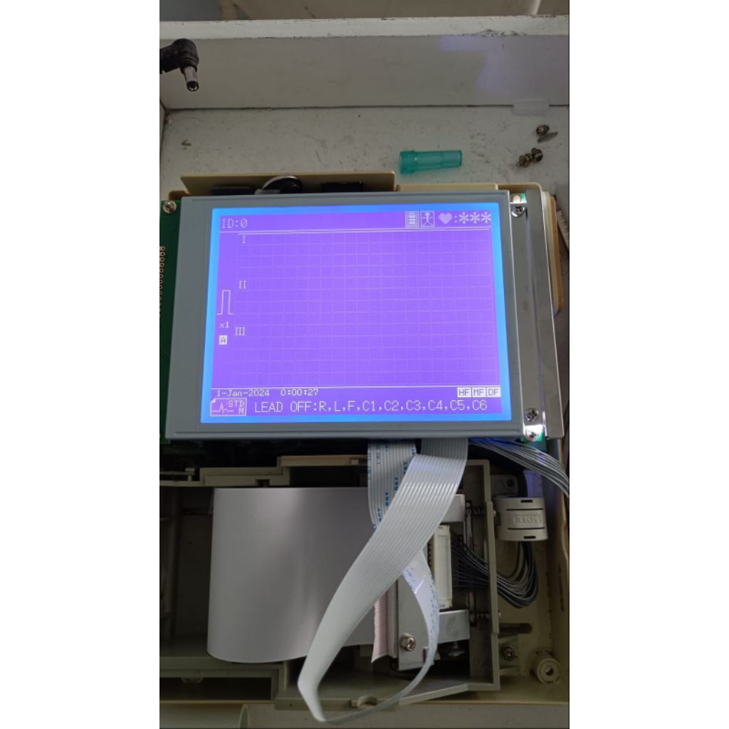 Lcd Fukuda Denshi CardiMax FX-7102  Alat Mesin ECG/EKG