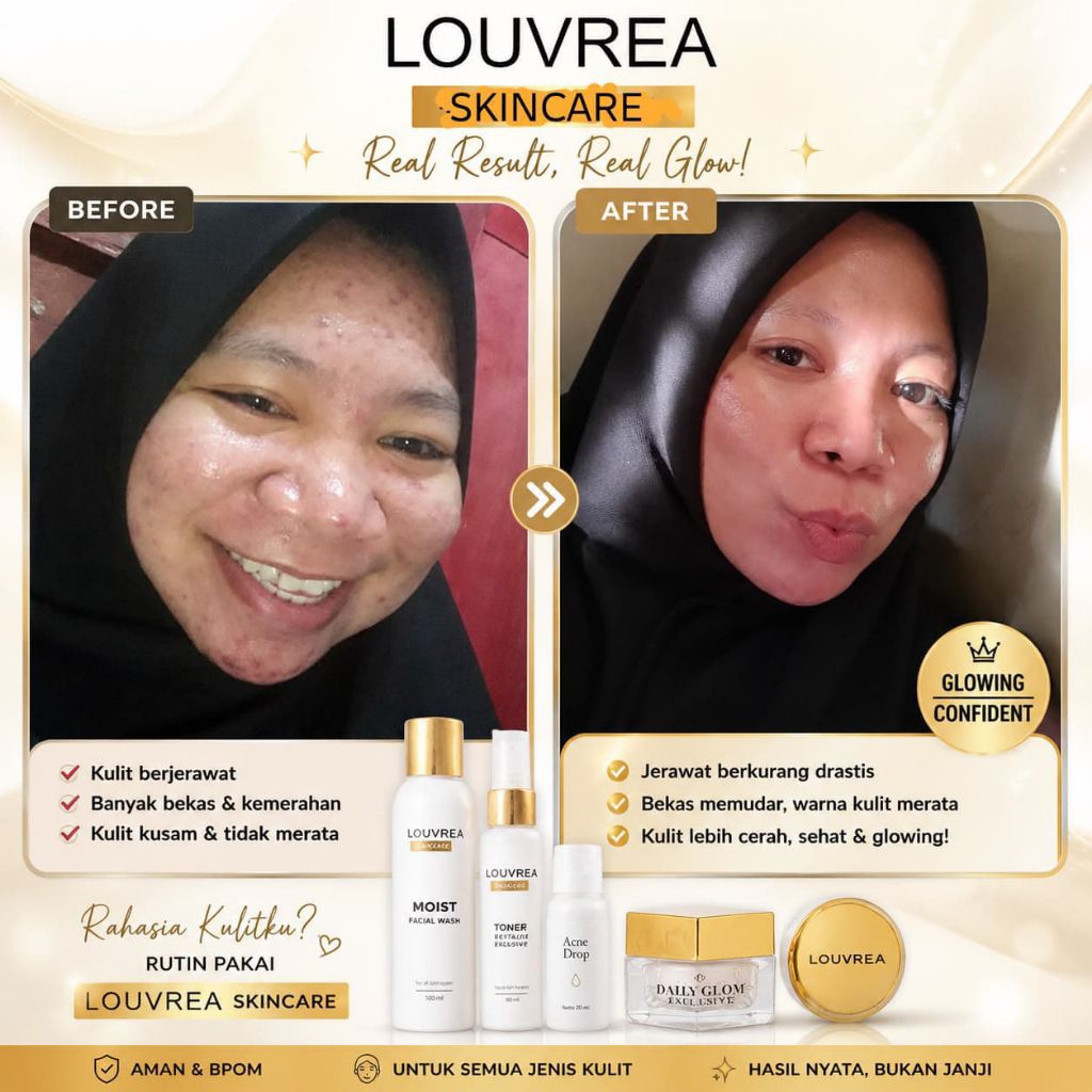 Paket diamond 1 plus acne drop Louvrea skincare.