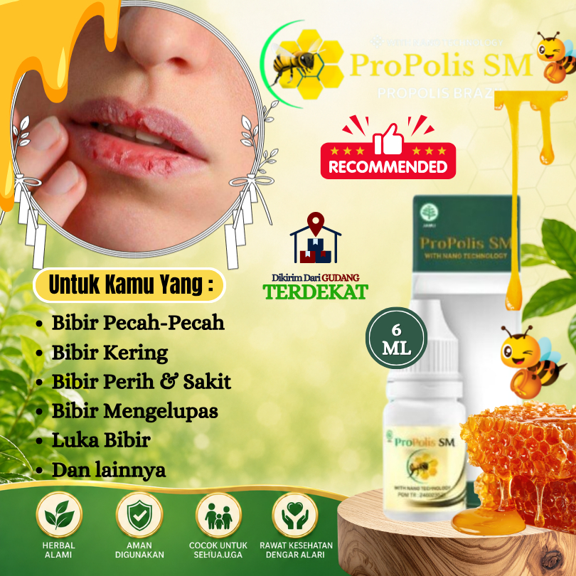 ProPolis SM - Obat Tetes Bibir Pecah-Pecah, Obat Bibir Kering, Obat Bibir Kering Pecah Berdarah, Oba