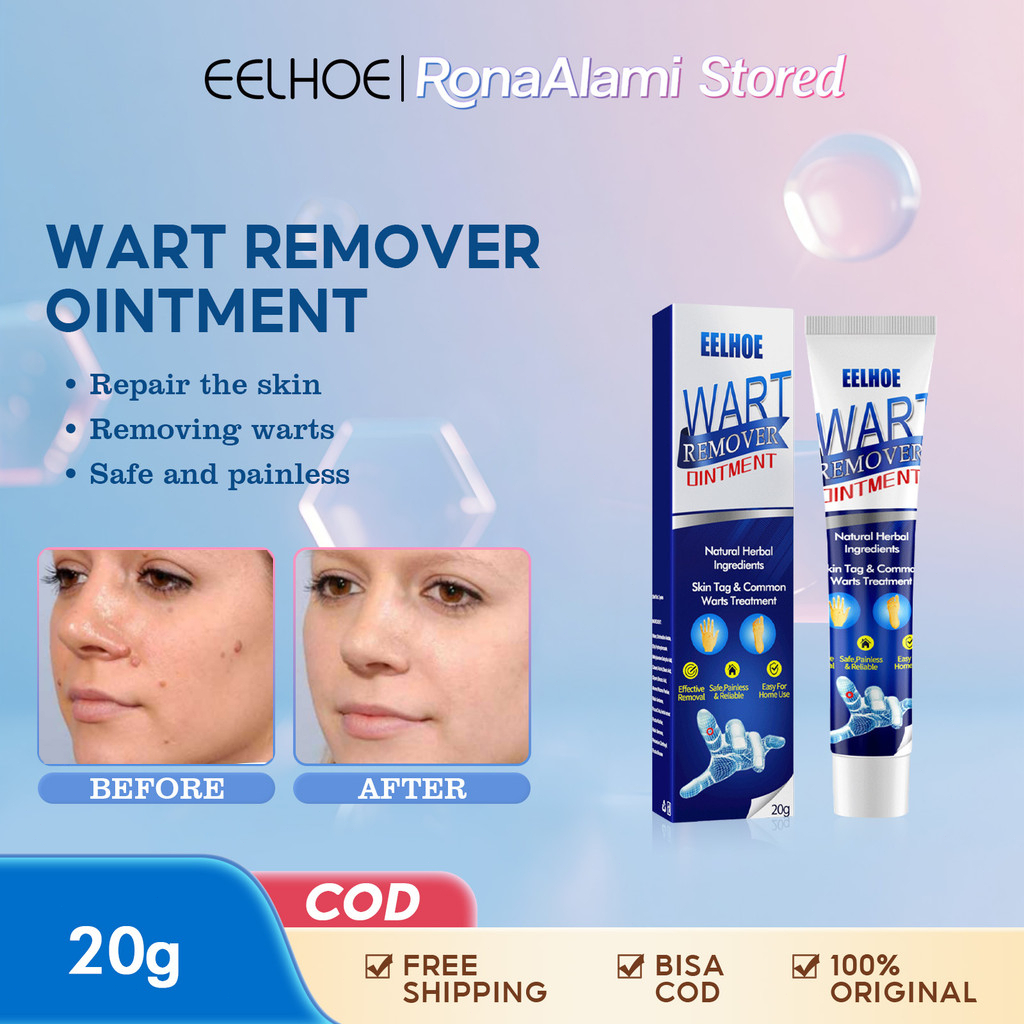 EELHOE Wart Remover Cream 20g Penghilang Tahi Lalat Kutil Obat Penghilang Kutil Wajah Skin Tag Remov