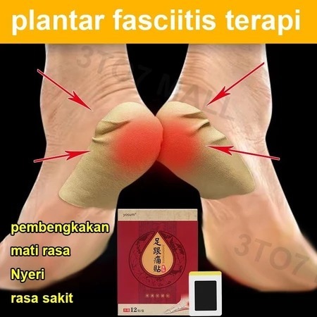 Sakit Tumit Koyo Kaki Pereda Nyeri Plantar Fasciitis Terapi Obat Sakit Kaki Obat Sakit Telapak Kaki 
