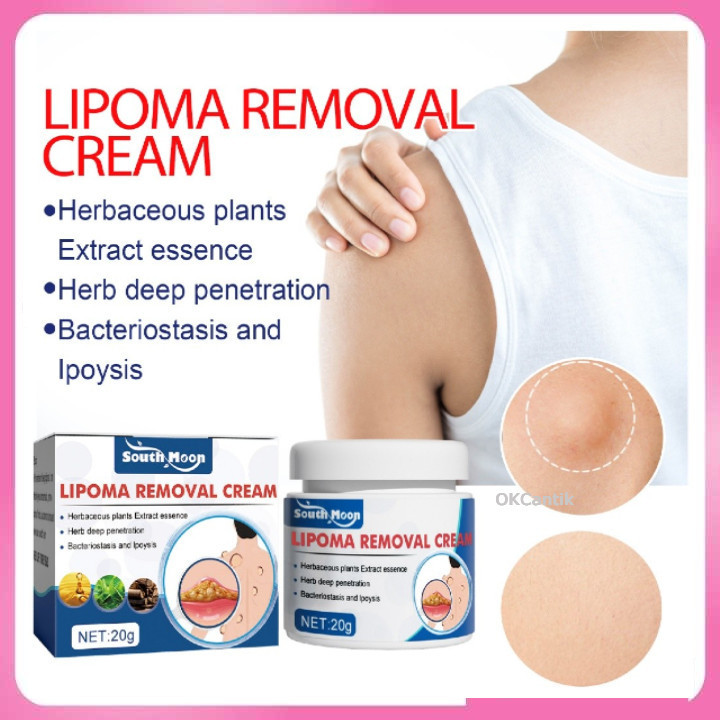 Lipoma Removal Cream Original